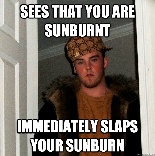 sees that you are sunburnt immediately slaps your sunburn - sees that you are sunburnt immediately slaps your sunburn  Scumbag Steve