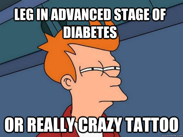 leg in advanced stage of diabetes or really crazy tattoo - leg in advanced stage of diabetes or really crazy tattoo  Futurama Fry