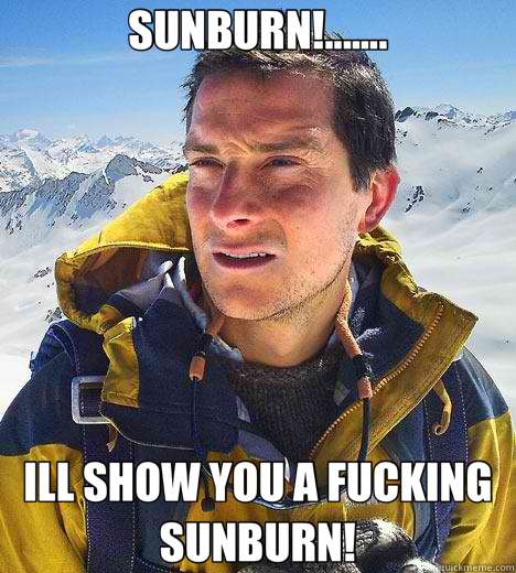 SUNBURN!....... ILL SHOW YOU A FUCKING SUNBURN! - SUNBURN!....... ILL SHOW YOU A FUCKING SUNBURN!  Bear Grylls