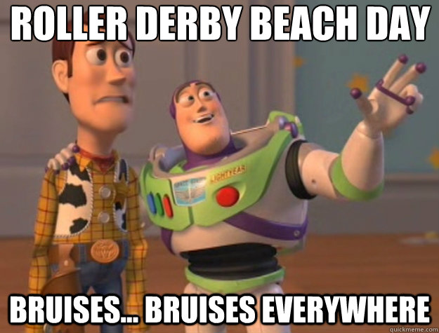 roller derby beach day bruises... bruises everywhere - roller derby beach day bruises... bruises everywhere  Toy Story