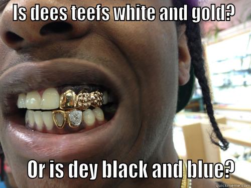 IS DEES TEEFS WHITE AND GOLD?     OR IS DEY BLACK AND BLUE? Misc