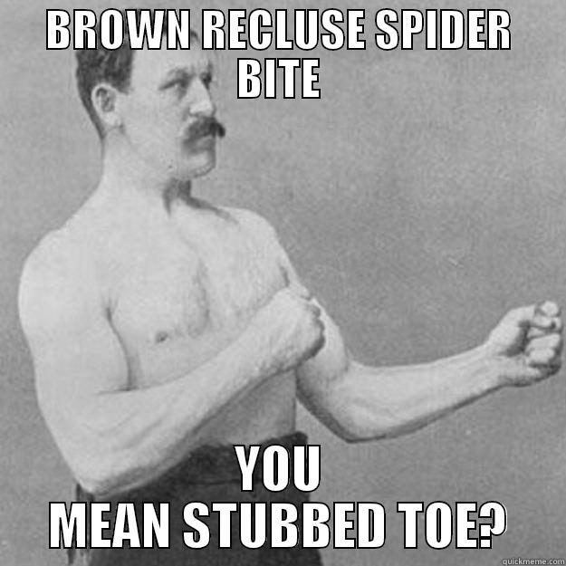 FLIPPIN SPIDER? - BROWN RECLUSE SPIDER BITE YOU MEAN STUBBED TOE? overly manly man