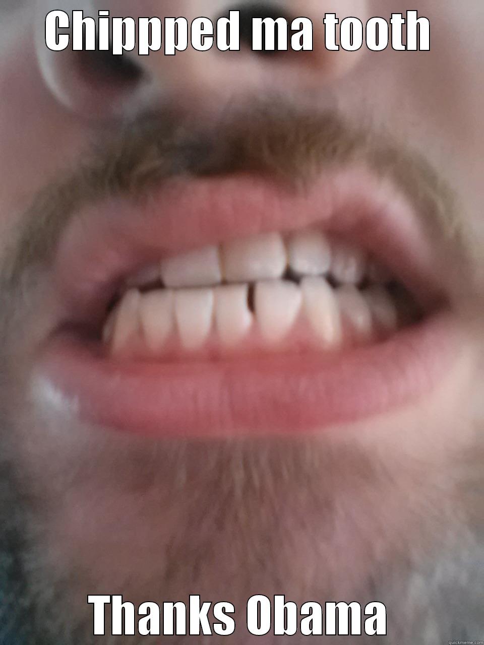 CHIPPPED MA TOOTH THANKS OBAMA Misc