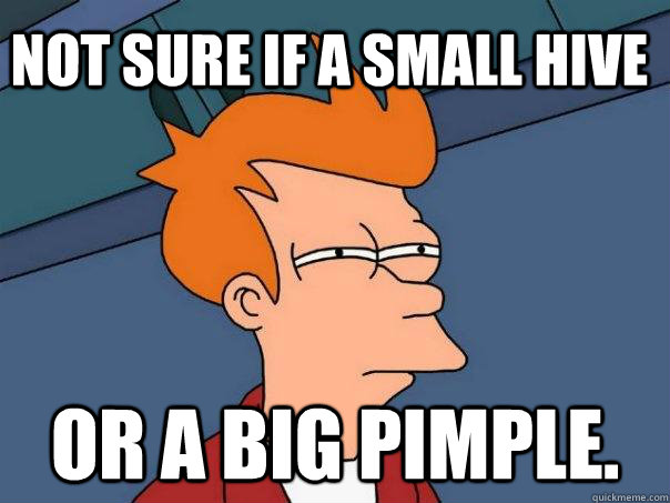 Not sure if a small hive or a big pimple.  Futurama Fry