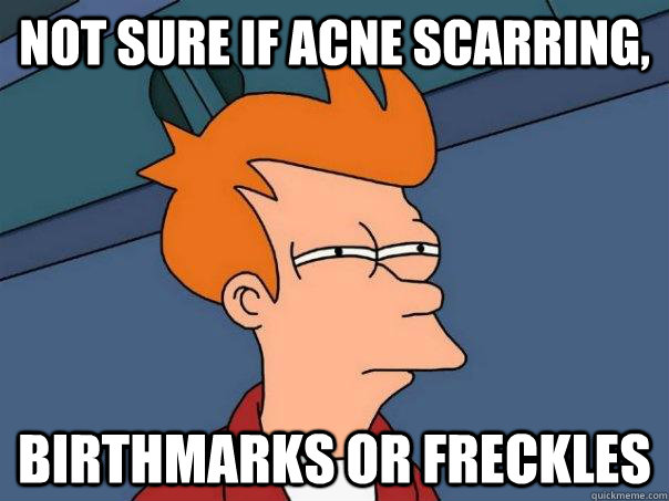 not sure if acne scarring, Birthmarks or Freckles  Futurama Fry