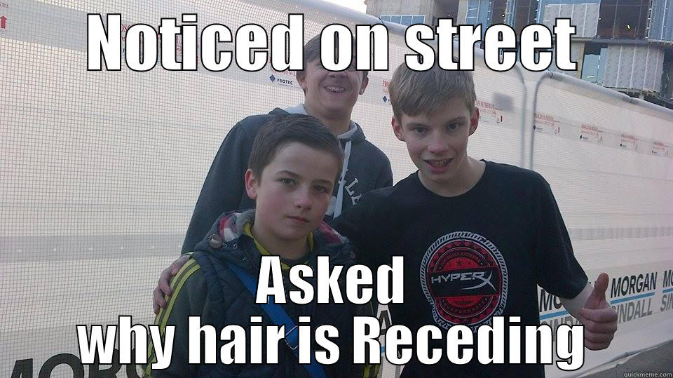 NOTICED ON STREET ASKED WHY HAIR IS RECEDING Misc