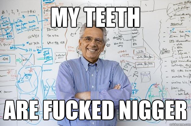 my teeth are fucked nigger - my teeth are fucked nigger  Engineering Professor