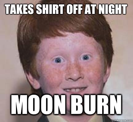 Takes shirt off at night Moon burn   Over Confident Ginger