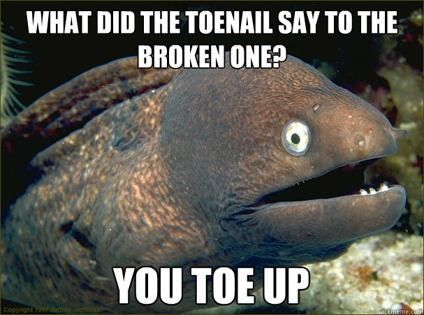 What did the toenail say to the broken one? You toe up - What did the toenail say to the broken one? You toe up  Bad Joke Eel