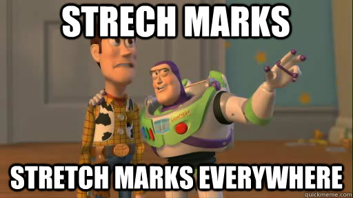 Strech marks Stretch marks everywhere - Strech marks Stretch marks everywhere  Everywhere