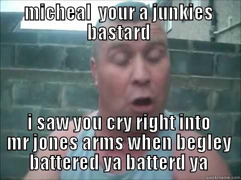 MICHEAL  YOUR A JUNKIES BASTARD I SAW YOU CRY RIGHT INTO MR JONES ARMS WHEN BEGLEY BATTERED YA BATTERD YA Misc