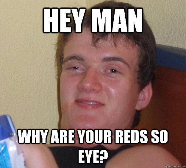 Hey man Why are your reds so eye? - Hey man Why are your reds so eye?  10 Guy