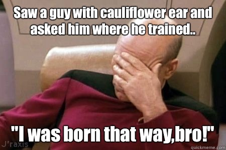 Saw a guy with cauliflower ear and asked him where he trained.. 