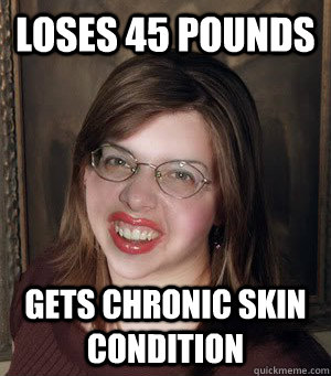 Loses 45 pounds Gets chronic skin condition  Bad luck Brianna