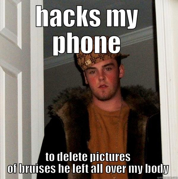 scumbag ex - HACKS MY PHONE TO DELETE PICTURES OF BRUISES HE LEFT ALL OVER MY BODY Scumbag Steve