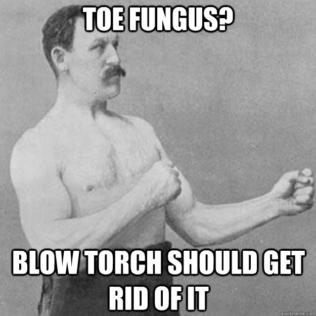 Toe fungus? Blow torch should get rid of it - Toe fungus? Blow torch should get rid of it  overly manly man