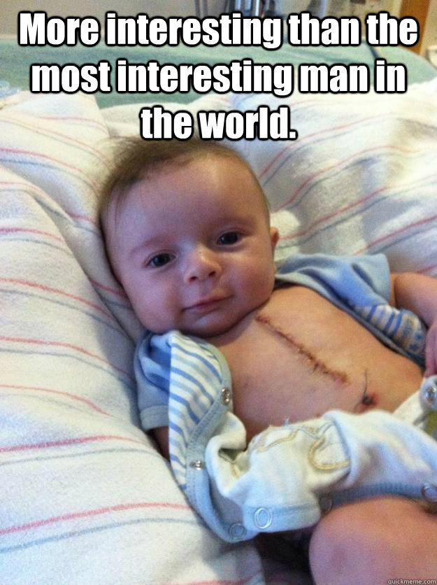 More interesting than the most interesting man in the world.  Ridiculously Goodlooking Surgery Baby