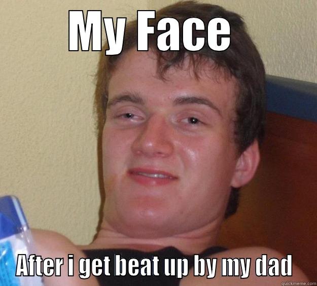 fuck lol  - MY FACE  AFTER I GET BEAT UP BY MY DAD  10 Guy