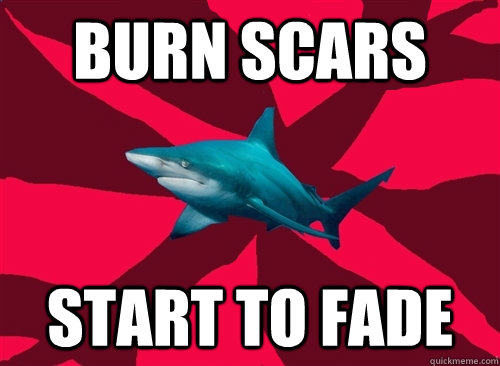 Burn scars start to fade  Self-Injury Shark