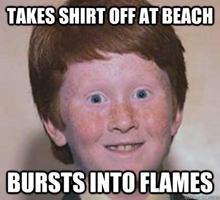 Takes shirt off at beach bursts into flames  