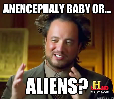 Anencephaly baby or... Aliens?  History Channel Guy