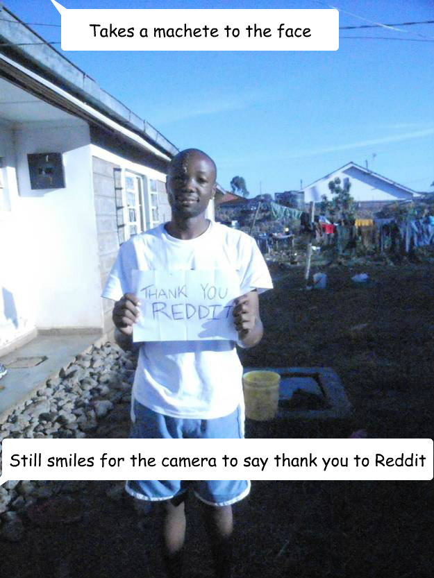 Takes a machete to the face Still smiles for the camera to say thank you to Reddit  