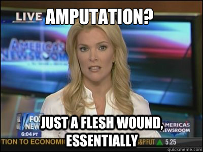 Amputation? Just a flesh wound, essentially  Megyn Kelly