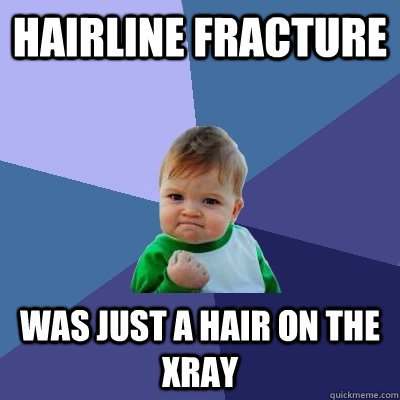 Hairline fracture was just a hair on the xray  Success Kid