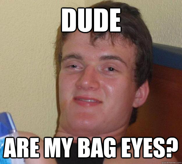 Dude
 Are my bag eyes?  10 Guy