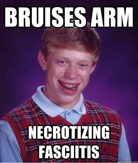 bruises arm necrotizing fasciitis - bruises arm necrotizing fasciitis  Bad Luck Brian