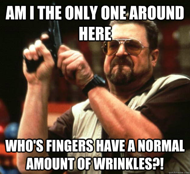 am I the only one around here who's fingers have a normal amount of wrinkles?!  Angry Walter