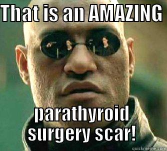 THAT IS AN AMAZING  PARATHYROID SURGERY SCAR! Matrix Morpheus