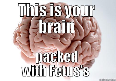 THIS IS YOUR BRAIN PACKED WITH FETUS'S  Scumbag Brain