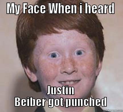 MY FACE WHEN I HEARD JUSTIN BEIBER GOT PUNCHED Over Confident Ginger