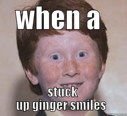 gingers should burn  - WHEN A  STUCK UP GINGER SMILES  Over Confident Ginger