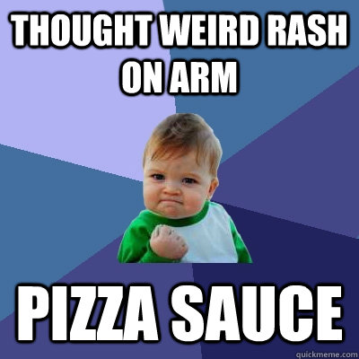 Thought Weird Rash on Arm Pizza Sauce  Success Kid