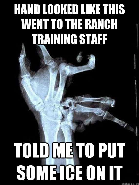 hand looked like this went to the ranch training staff told me to put some ice on it - hand looked like this went to the ranch training staff told me to put some ice on it  Broken Hand