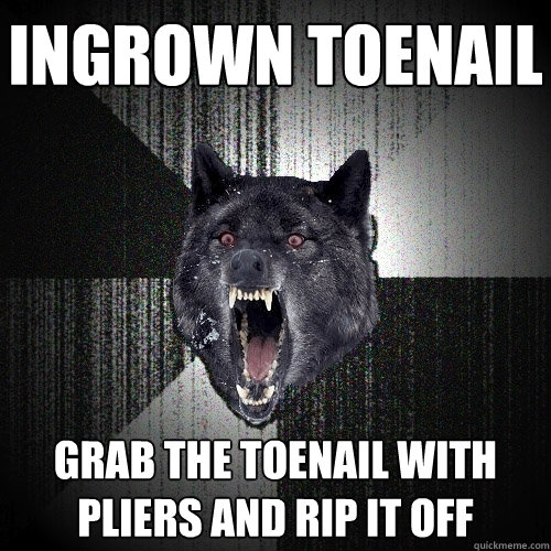 Ingrown toenail Grab the toenail with pliers and rip it off  Insanity Wolf