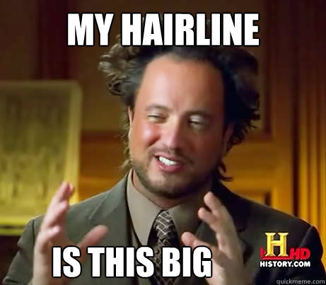 MY HAIRLINE IS THIS BIG  History Channel Guy