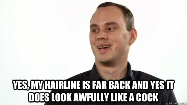  yes, my hairline is far back and yes it does look awfully like a cock -  yes, my hairline is far back and yes it does look awfully like a cock  Nice Phreak