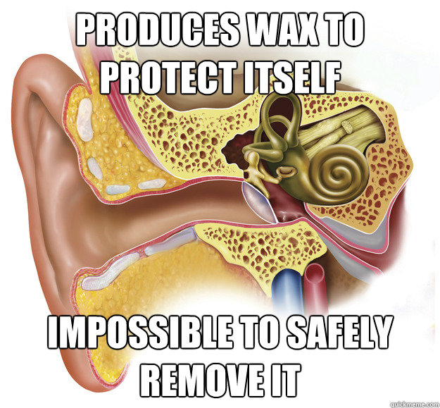 produces wax to protect itself impossible to safely remove it - produces wax to protect itself impossible to safely remove it  Scumbag Ear