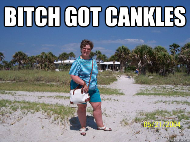 bitch got cankles  - bitch got cankles   Misc