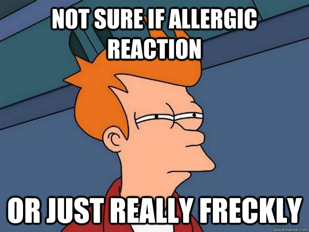 Not sure if allergic reaction or just really freckly - Not sure if allergic reaction or just really freckly  Futurama Fry