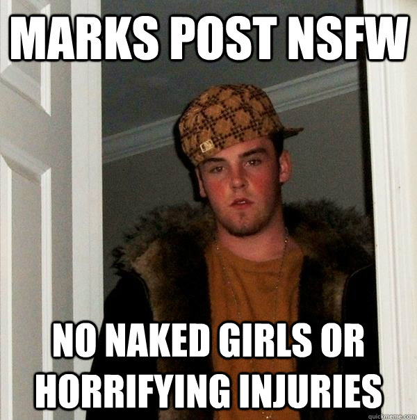 Marks post NSFW NO NAKED GIRLS or horrifying injuries  Scumbag Steve