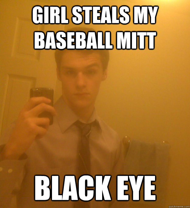 Girl steals my baseball mitt black eye  