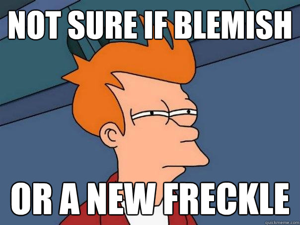 Not sure if blemish or a new freckle - Not sure if blemish or a new freckle  Futurama Fry