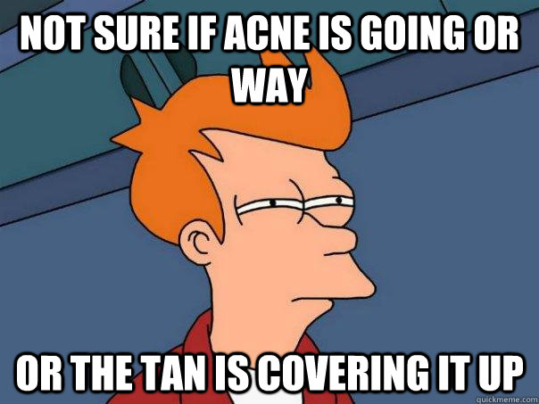 Not sure if acne is going or way Or the tan is covering it up - Not sure if acne is going or way Or the tan is covering it up  Futurama Fry