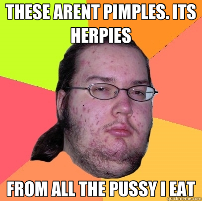 THESE ARENT PIMPLES. ITS HERPIES FROM ALL THE PUSSY I EAT - THESE ARENT PIMPLES. ITS HERPIES FROM ALL THE PUSSY I EAT  Butthurt Dweller