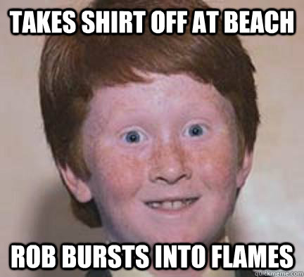 Takes shirt off at beach rob bursts into flames - Takes shirt off at beach rob bursts into flames  Over Confident Ginger