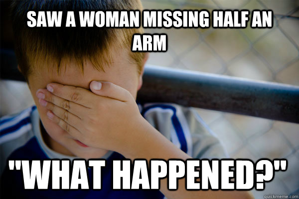 Saw a woman missing half an arm 